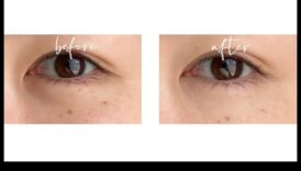 Elixirele de sub a tinti A clasa la repetare cercurilor întunecate cu corectorul deplin 1 Elixire de sub ochi: alunga cearcanele cu corectorul perfect