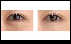 Elixire de sub ochi: alunga cearcanele cu corectorul perfect