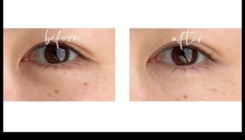 Elixire de sub ochi: alunga cearcanele cu corectorul perfect