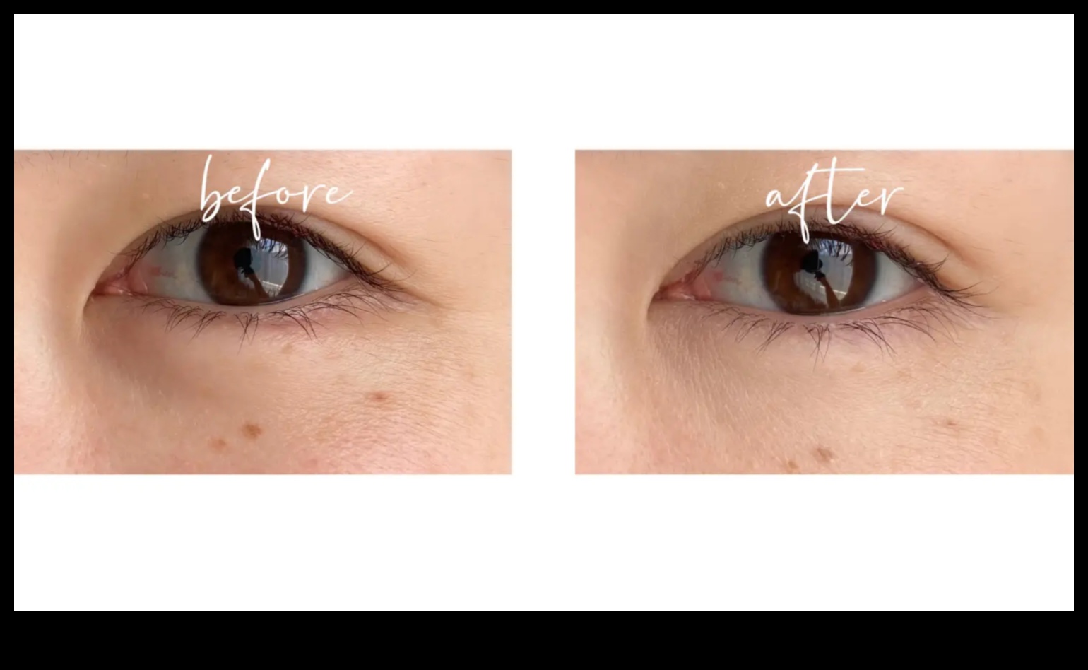 Elixire de sub ochi: alunga cearcanele cu corectorul perfect